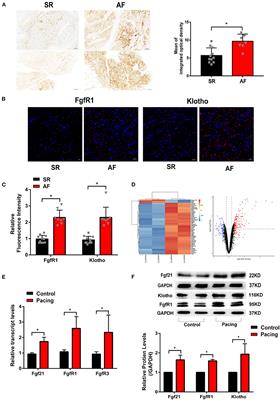 Fibroblast Growth Factor 21 Protects Against Atrial Remodeling via Reducing Oxidative Stress